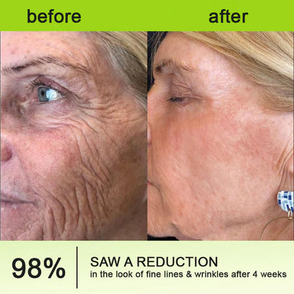 🔥Final 3 Hours: 70%OFF🔥 QIAWI™ Botulinum & Vita-A Retinol Shot Wrinkle-Lift Tightening cream✨