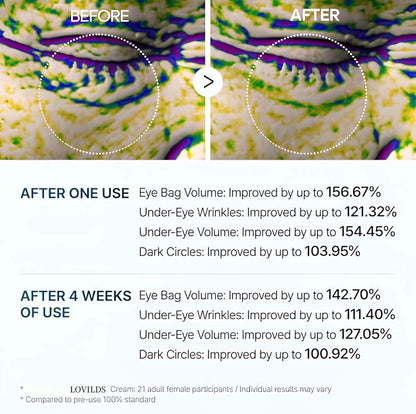 LOVILDS Revitalizing Under Eye Cream | Anti-Aging Moisturizer for Dark Circles, Puffiness & Fine Lines